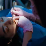 Aparat Ortodontyczny: W Czym Pomaga?
